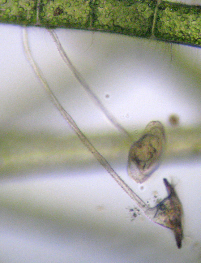 Forse Vorticella patellina